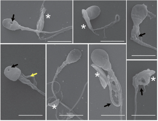小麦策略 5分钟就能“斩首”人类精子，这种藏在猫砂中的寄生虫可能已感染全球一半人口